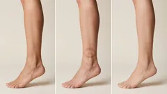 No Swelling: My Complete Anti-Swelling Routine That Always Helps Me